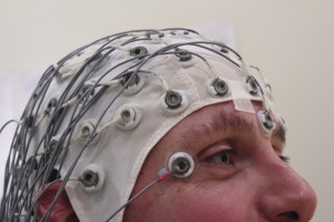 PNES relies heavily on EEG scans for its diagnosis